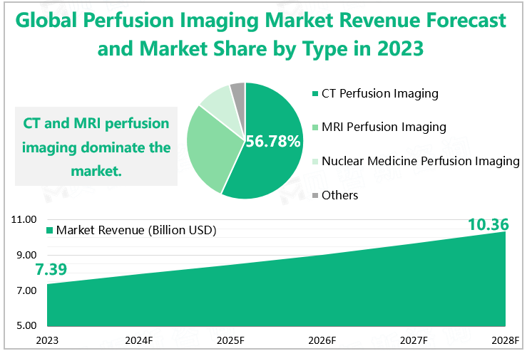 Global Perfusion Imaging Market Size Forecast and Market Share by Type in 2023 